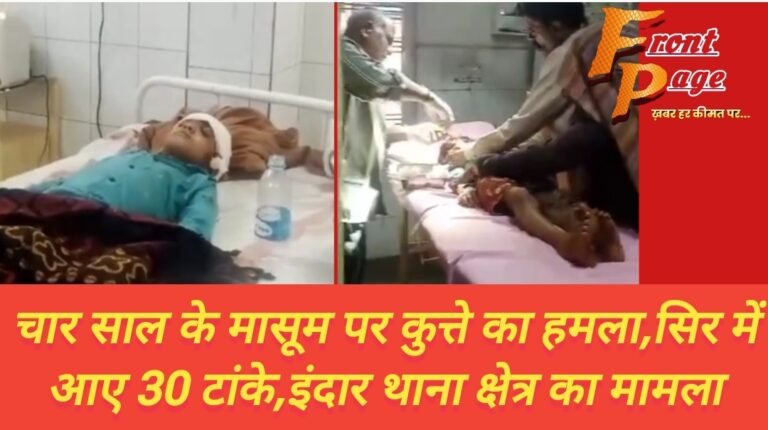 चार साल के मासूम पर कुत्ते का हमला,सिर में आए 30 टांके,इंदार थाना क्षेत्र का मामला