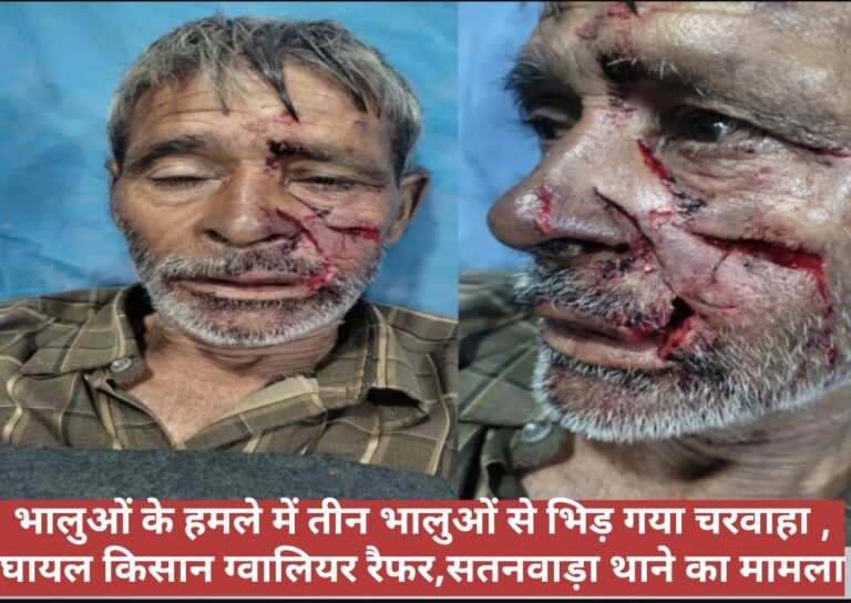 भालुओं के हमले में तीन भालुओं से भिड़ गया चरवाहा ,घायल किसान ग्वालियर रैफर,सतनवाड़ा थाने का मामला